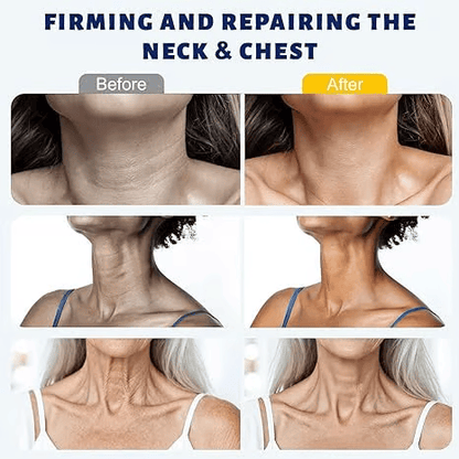 ✨Virellasbeauty™ Instant Neck Lift Cream  — 🧴 Infused with Retinol & Hyaluronic Acid | Firms the Neck, Reduces Wrinkles & Double Chin